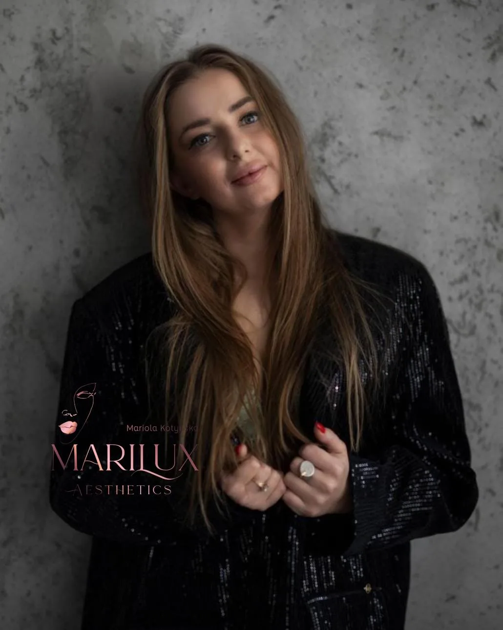 Lip filler portrait result — Marilux Aesthetics